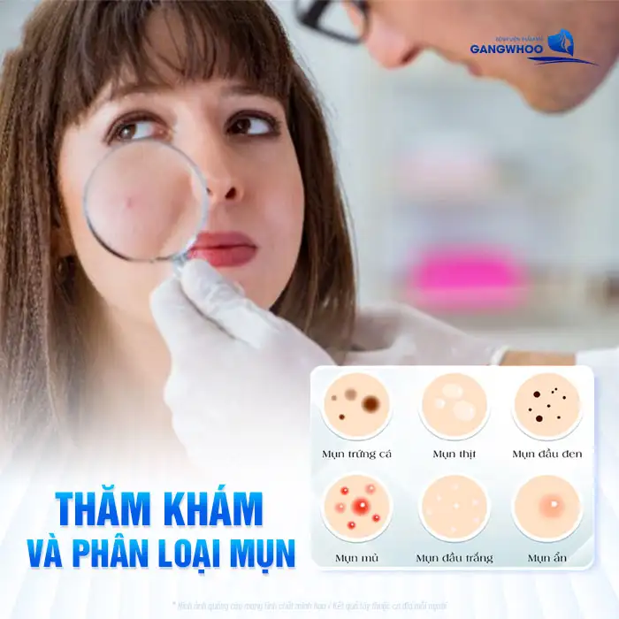 Tìm hiểu quy trỉnh điều trị mụn từng bước theo chuẩn y khoa