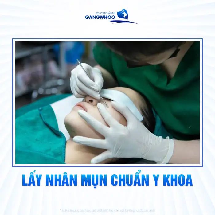 Tìm hiểu quy trỉnh điều trị mụn từng bước theo chuẩn y khoa