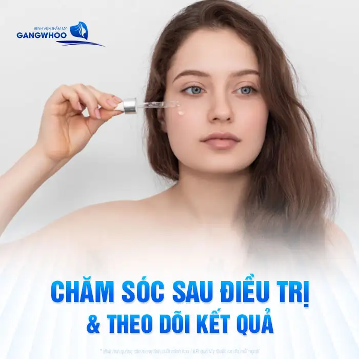 Tìm hiểu quy trỉnh điều trị mụn từng bước theo chuẩn y khoa
