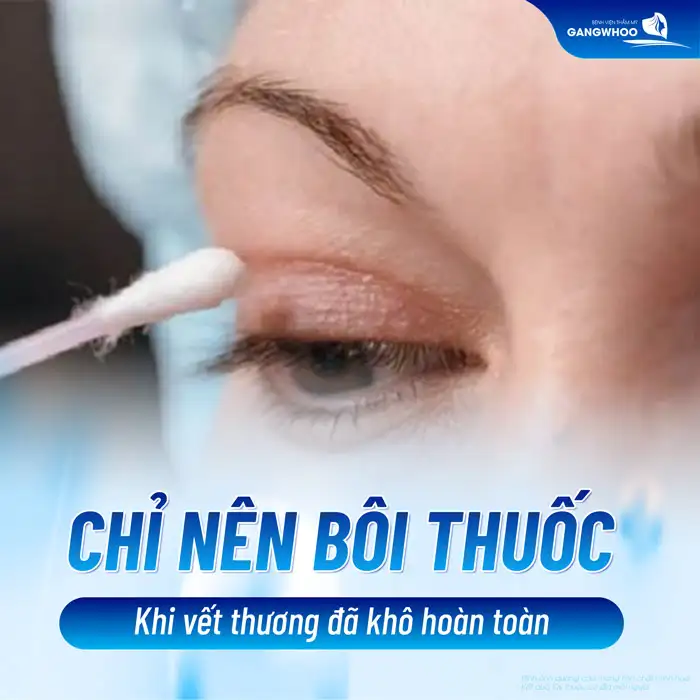 Top 3+ Thuốc liền sẹo sau cắt mí? Những lưu ý khi sử dụng