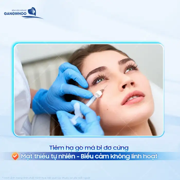 Tiêm hạ gò má bị đơ có nguy hiểm không? Nguyên nhân và cách khắc phục