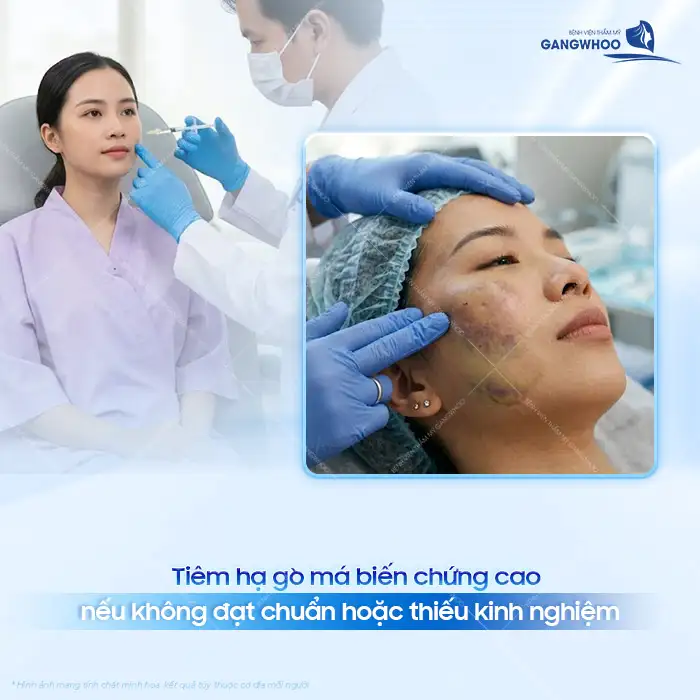 Tiêm hạ gò má có nguy hiểm không? Rủi ro và cách phòng tránh