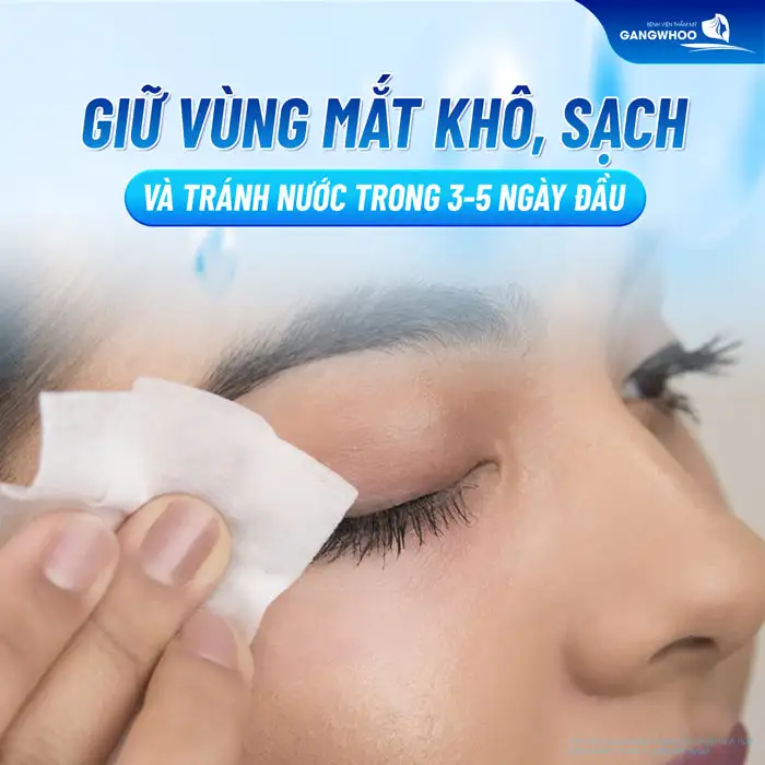Trước và sau cắt mí cần lưu ý những gì để đảm bảo an toàn, hiệu quả