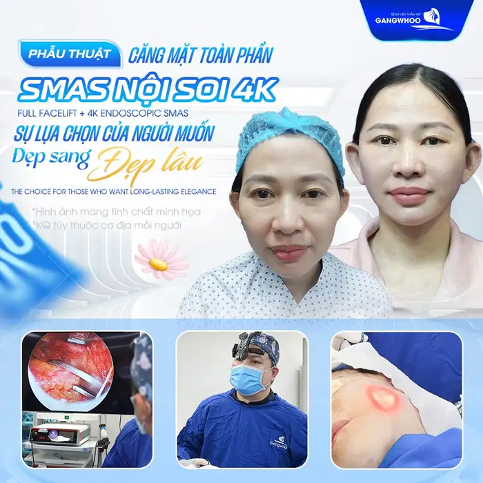 Uống gì để da mặt căng mịn, trắng sáng? Nên tránh các loại thức uống nào