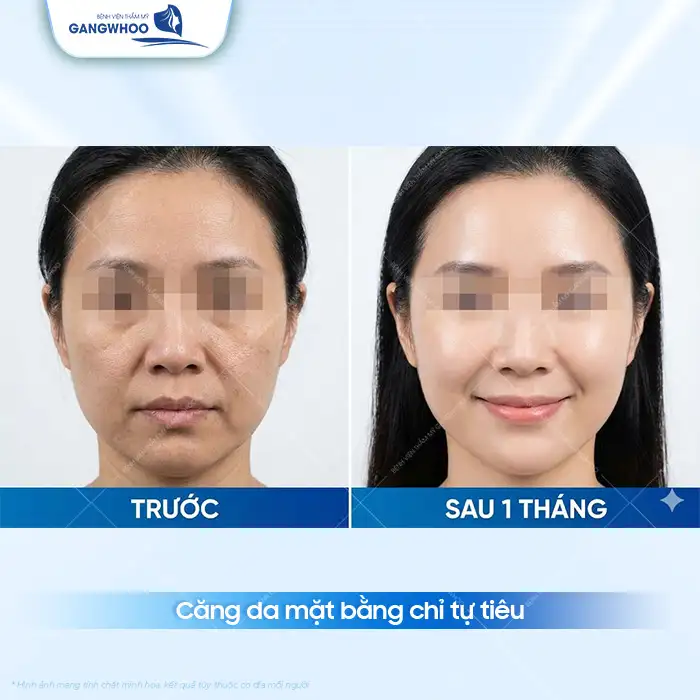 Uống gì để da mặt căng mịn, trắng sáng? Nên tránh các loại thức uống nào