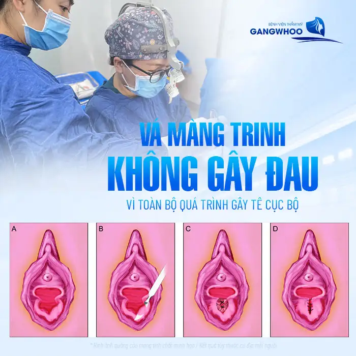 Vá màng trinh đau không? Cảm giác trong và sau khi thực hiện vá màng trinh