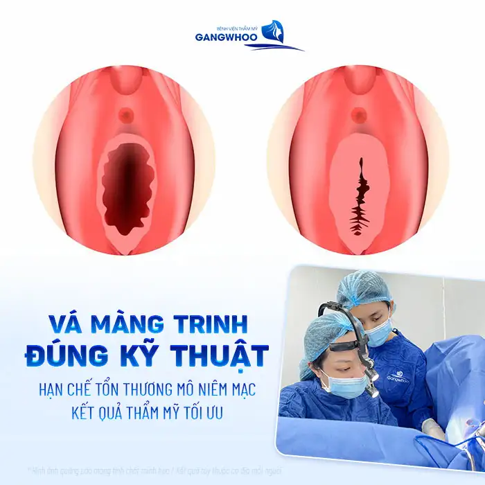 Vá màng trinh đau không? Cảm giác trong và sau khi thực hiện vá màng trinh