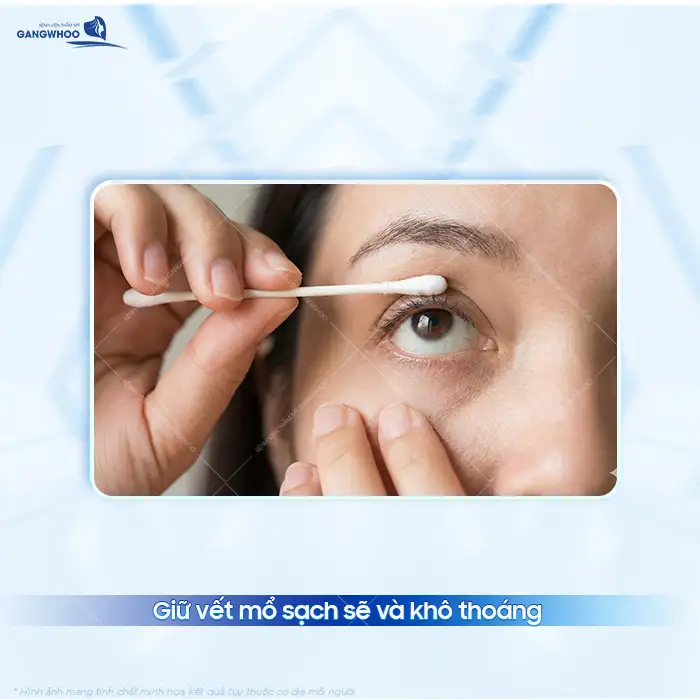 Vất cắt mí bị đỏ có phải là biến chứng? Nên khắc phục ra sao?