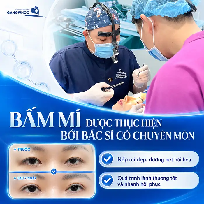 Nguyên nhân bấm mí bị trợn và cách khắc phục theo từng mức độ