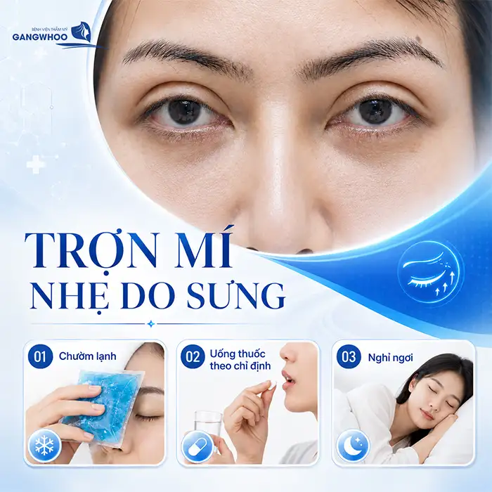 Nguyên nhân bấm mí bị trợn và cách khắc phục theo từng mức độ