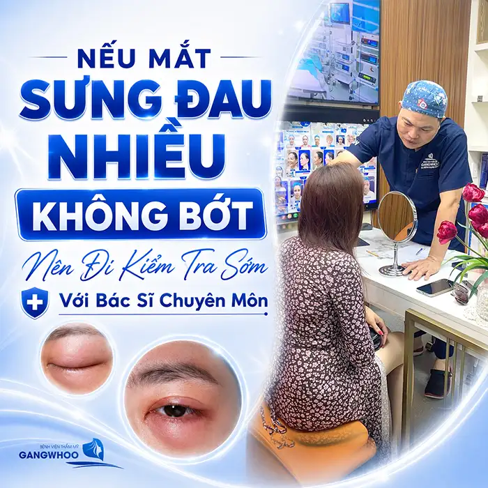 Bấm mí Hàn Quốc bao lâu hết sưng? Cách giảm sưng hiệu quả