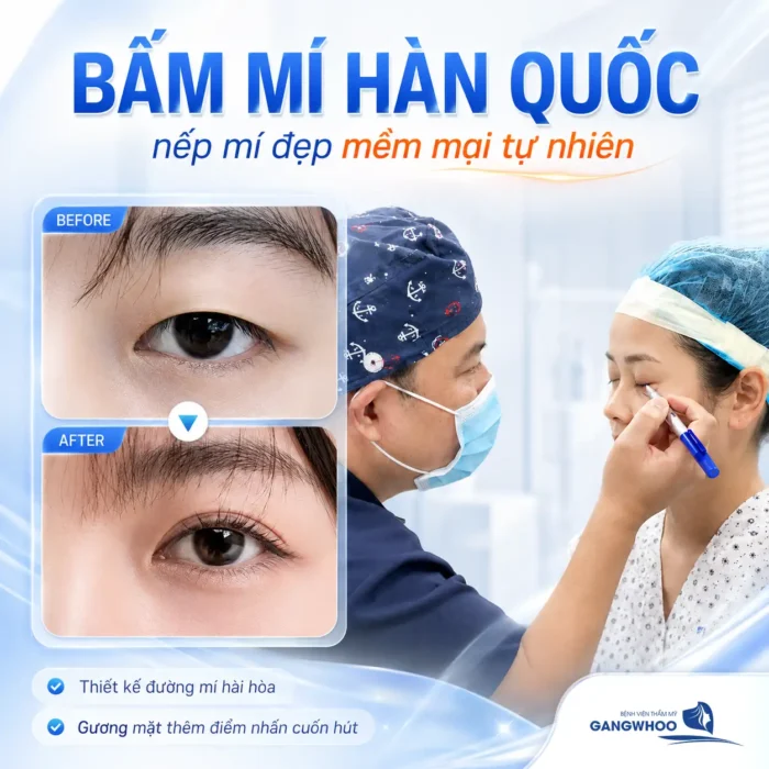 Bấm mí Hàn Quốc bao nhiêu tiền? Cập nhật bảng giá bấm mí 2025