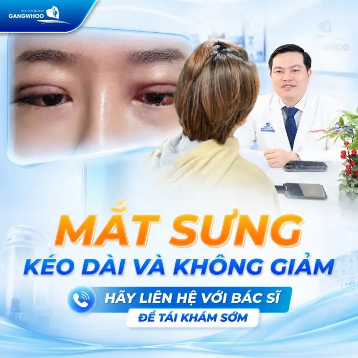 Bấm mí mắt bao lâu thì hết sưng? Cách giảm sưng hiệu quả