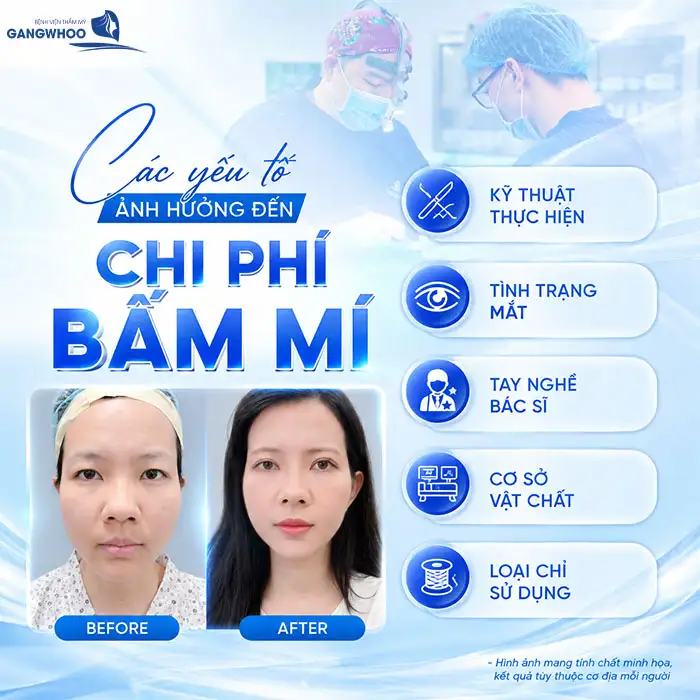 Bấm mí mắt giá bao nhiêu? Cập nhật bảng giá bấm mí 2025