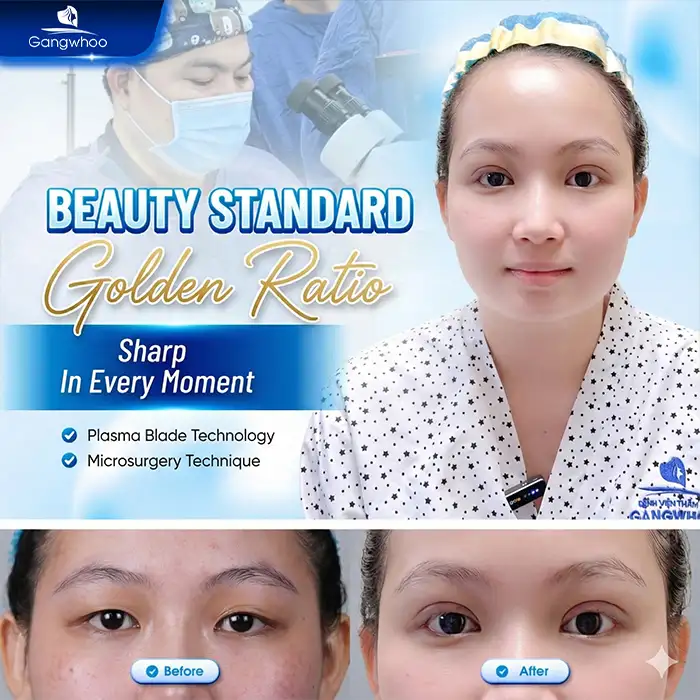 At what age can eyelid surgery be performed? Is it advisable to undergo eyelid surgery early?