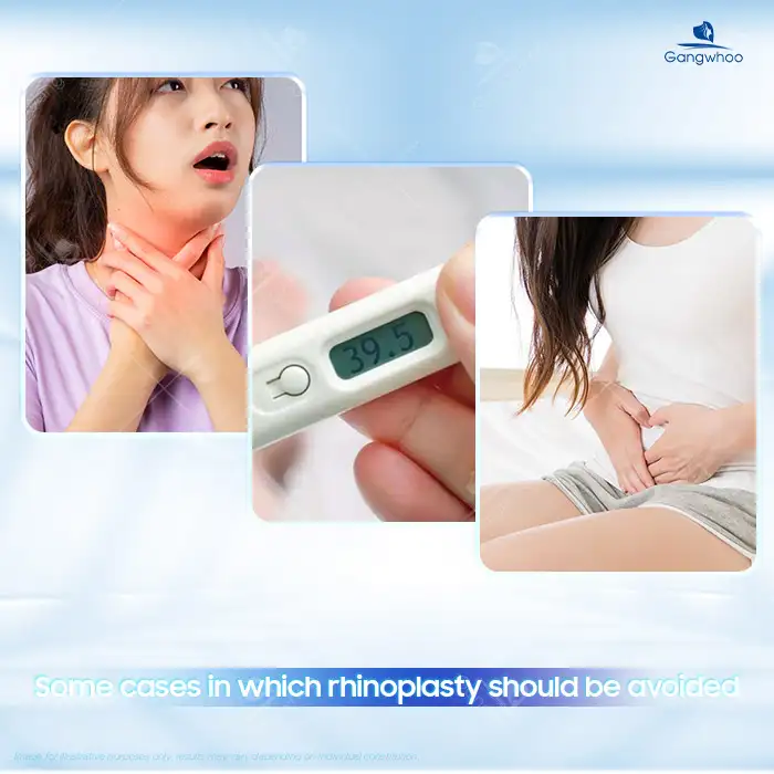Is it safe to undergo rhinoplasty when you have a cold? Can it cause complications?