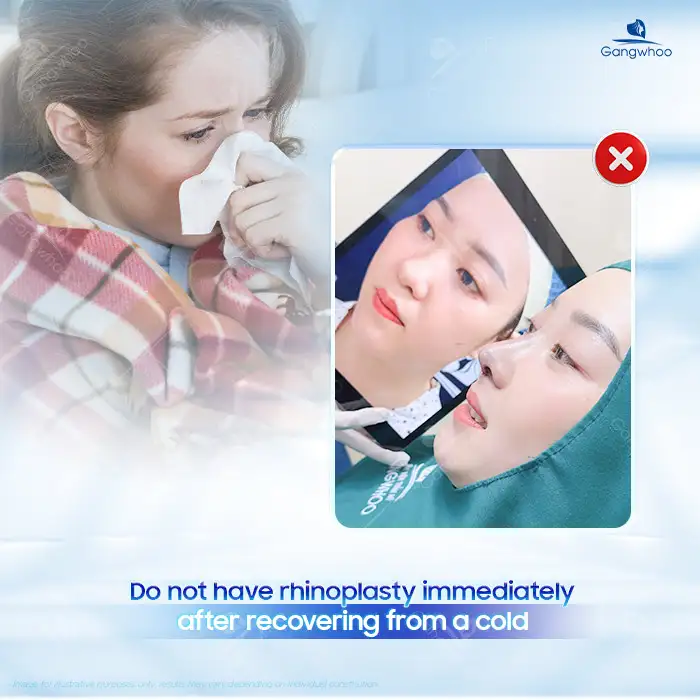 Is it safe to undergo rhinoplasty when you have a cold? Can it cause complications?