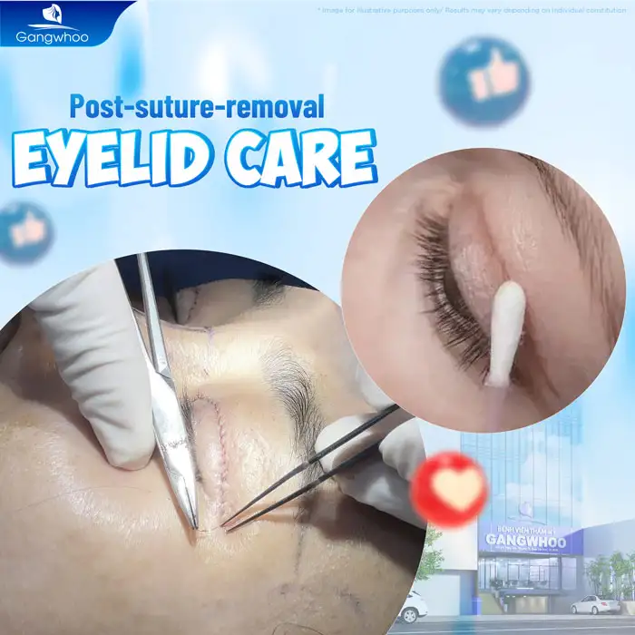How should eyelids be cared for after stitch removal? What should be noted?