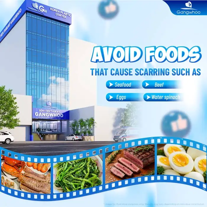 How should eyelids be cared for after stitch removal? What should be noted?