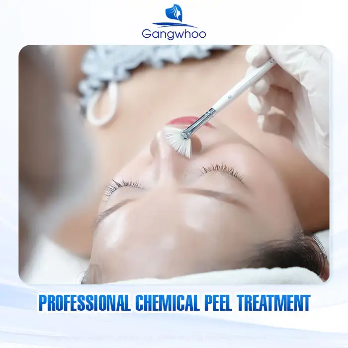 9+ Effective and Simple Ways to Treat Under-the-Skin Acne 8 9+ Effective and Simple Ways to Treat Under-the-Skin Acne