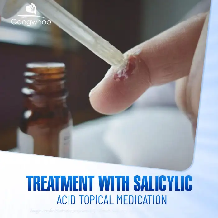 9+ Effective, Safe, and Root-Cause Wart Treatment Methods