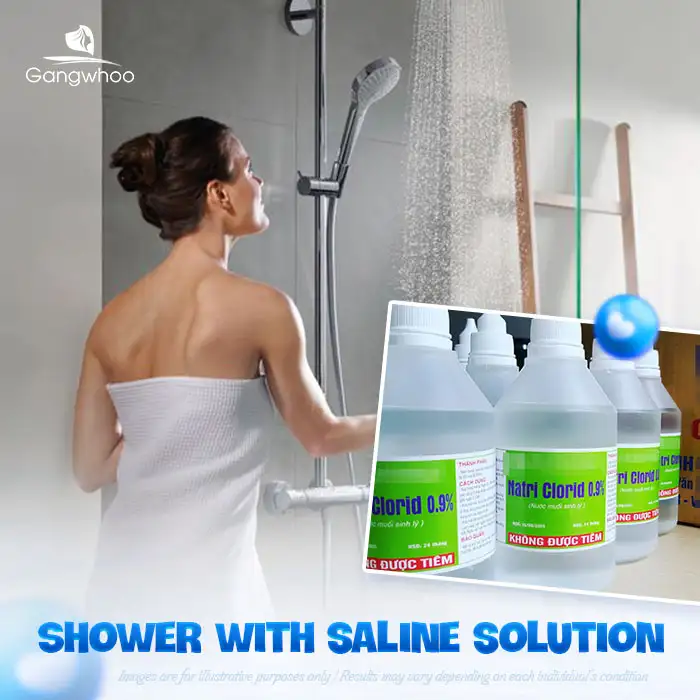 11+ Effective and Safe Back Acne Treatments You Can Do at Home