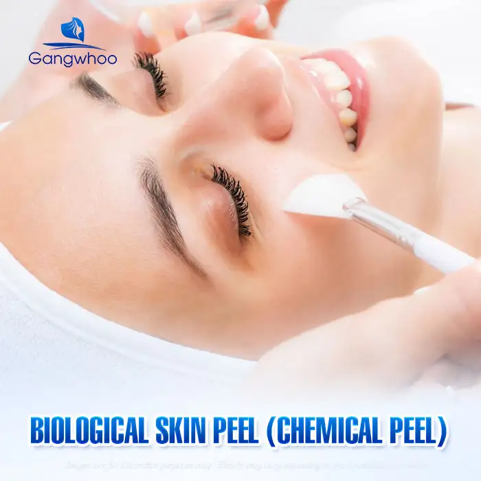 9+ Safe and Fast Methods to Treat Syringoma on the Face