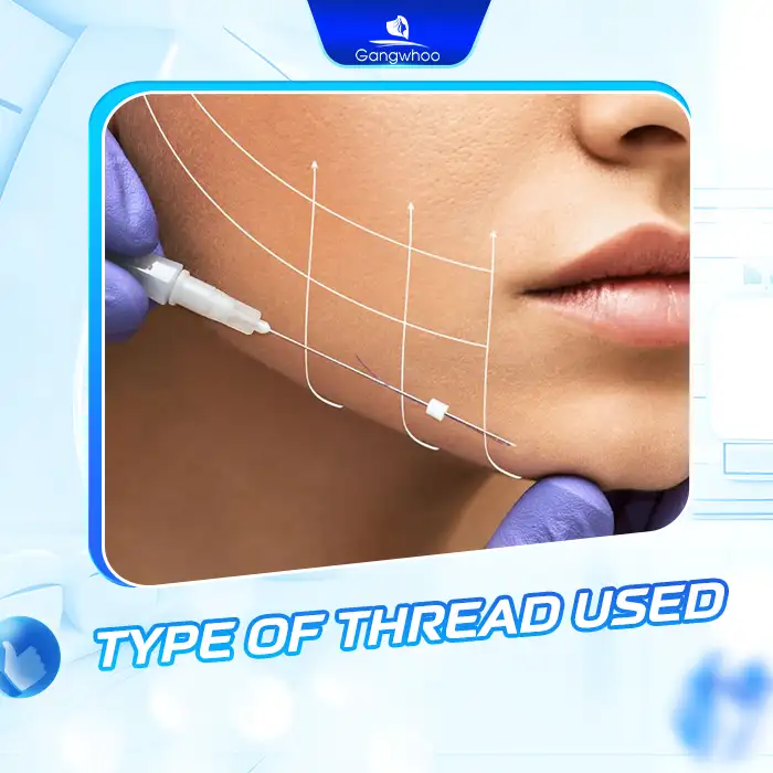 How Long Does Facial Thread Lifting Last? How to Maintain Long-Lasting Results?
