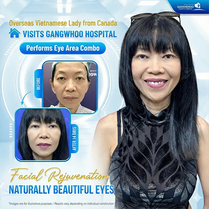 Is eyelid surgery safe at an older age? Are there any complications?
