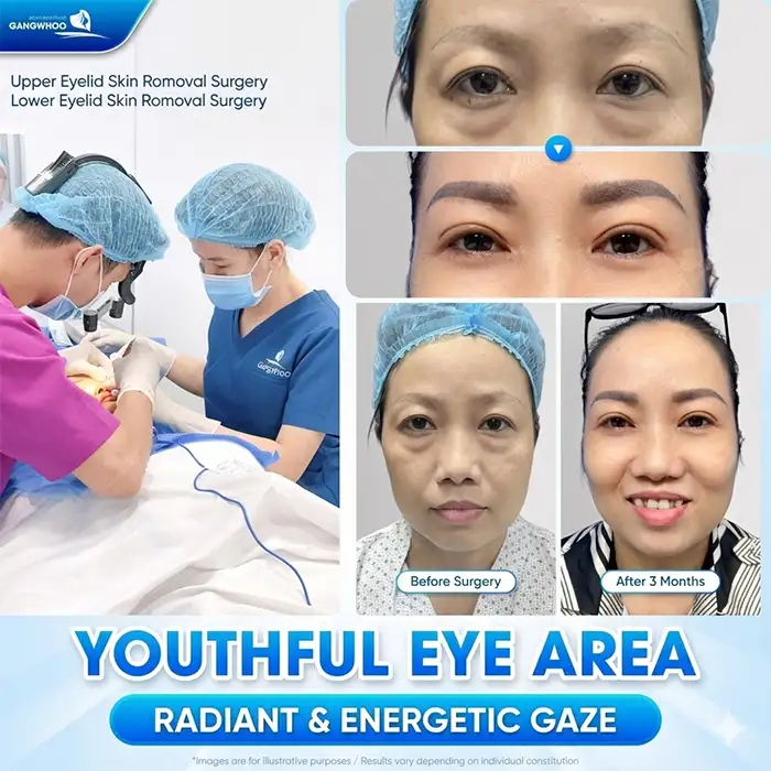 Is eyelid surgery safe at an older age? Are there any complications?