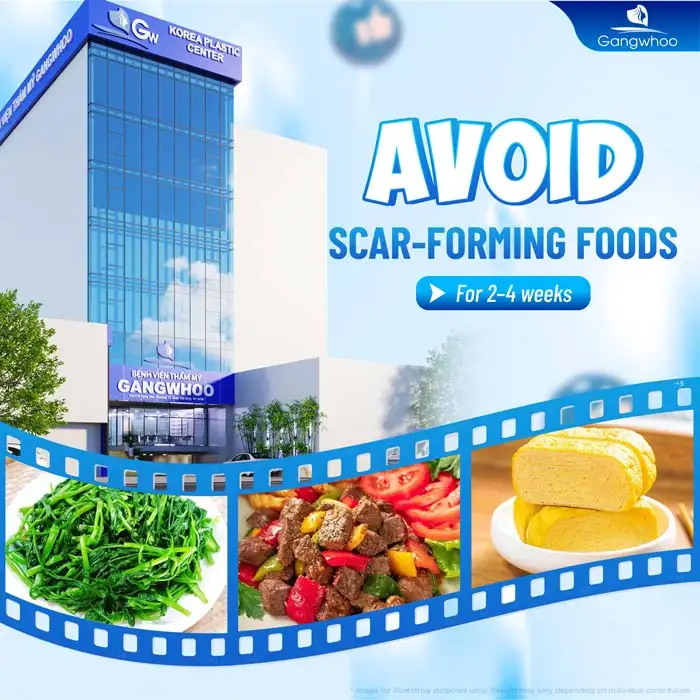 How long should you avoid certain foods after eyelid surgery? What should you eat after double eyelid surgery?