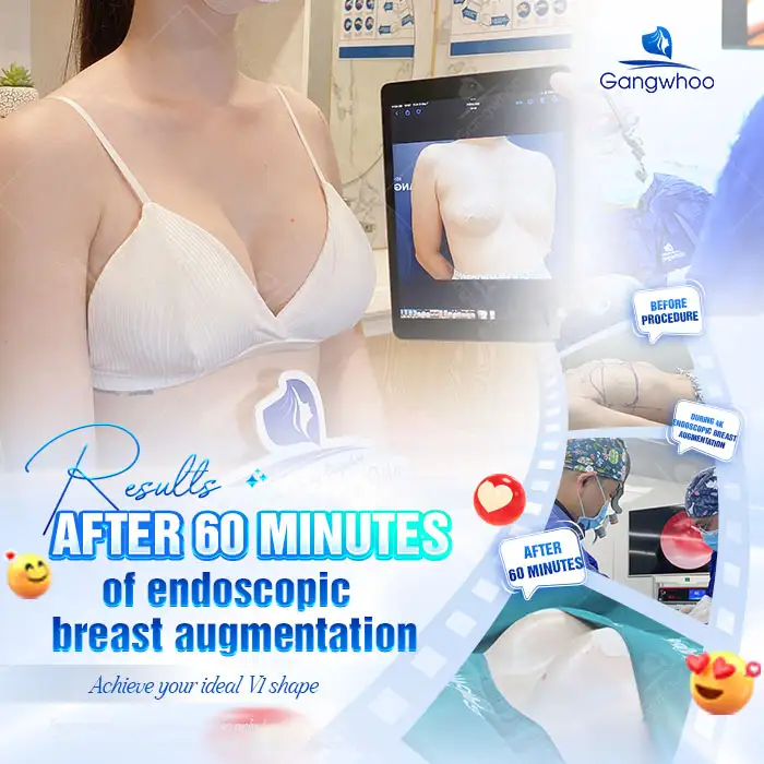 Should you get breast augmentation? Important considerations before breast augmentation