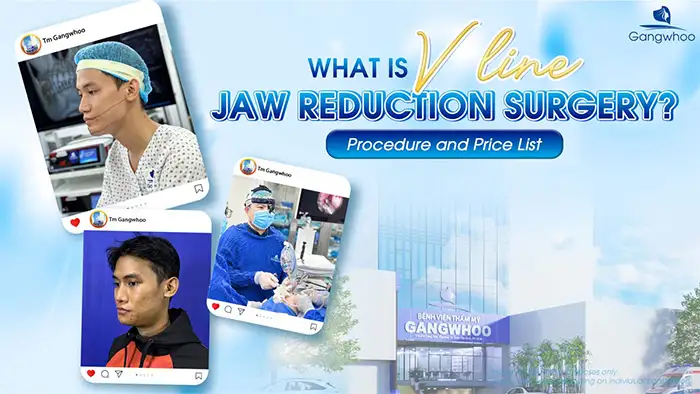 What Is V-Line Jaw Reduction Surgery? Procedure and Price List