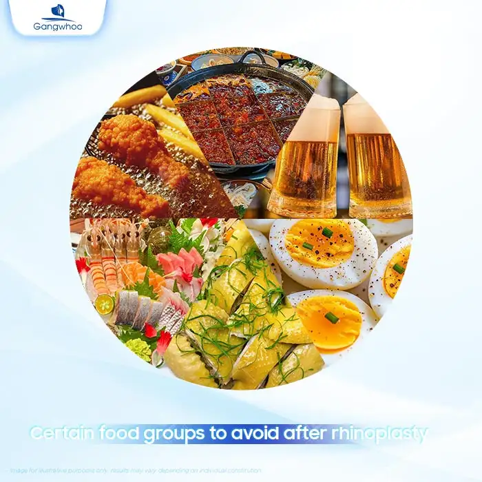 Can you eat fish cake noodle soup after rhinoplasty? Does it cause complications?