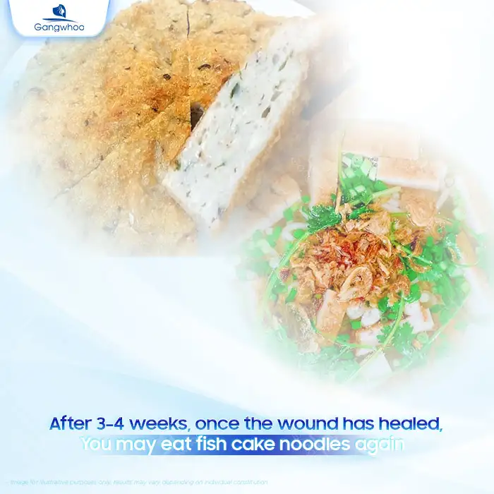 Can you eat fish cake noodle soup after rhinoplasty? Does it cause complications?