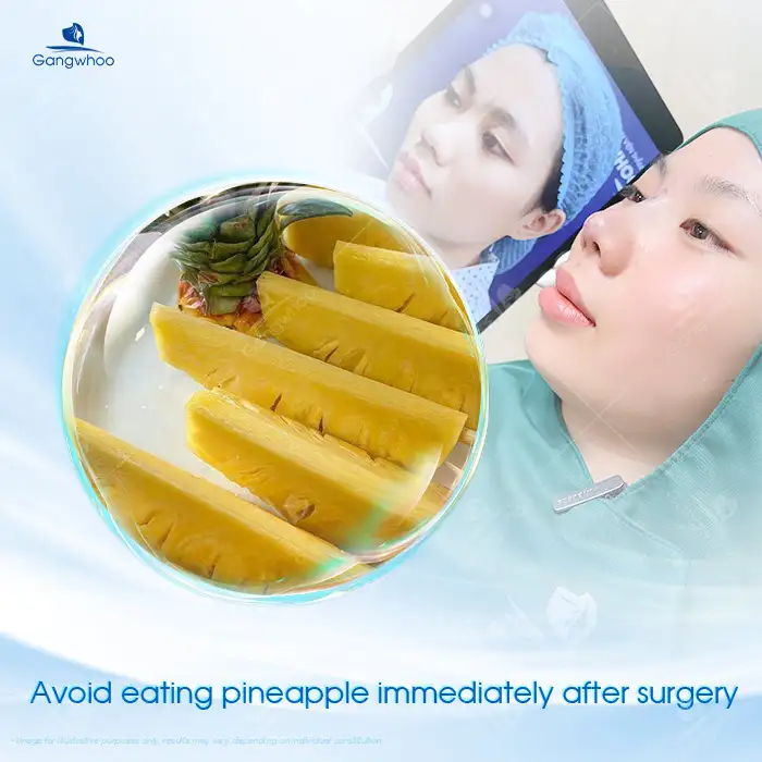 Can you eat pineapple after nose augmentation? Do you need to avoid pineapple?
