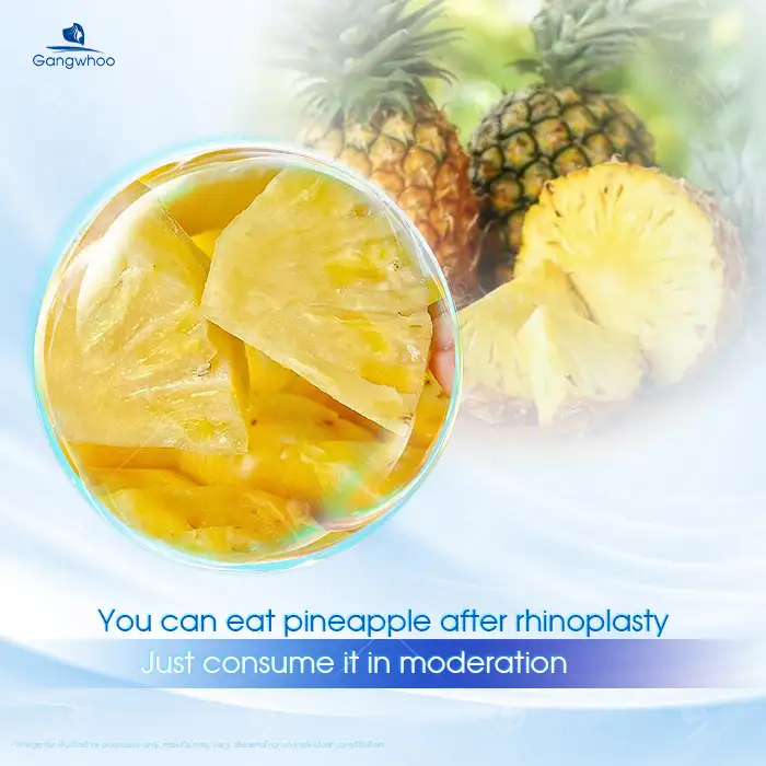 Can you eat pineapple after nose augmentation? Do you need to avoid pineapple?