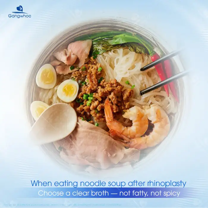 Can you eat hu tieu after nose augmentation? Notes when eating hu tieu after nose augmentation