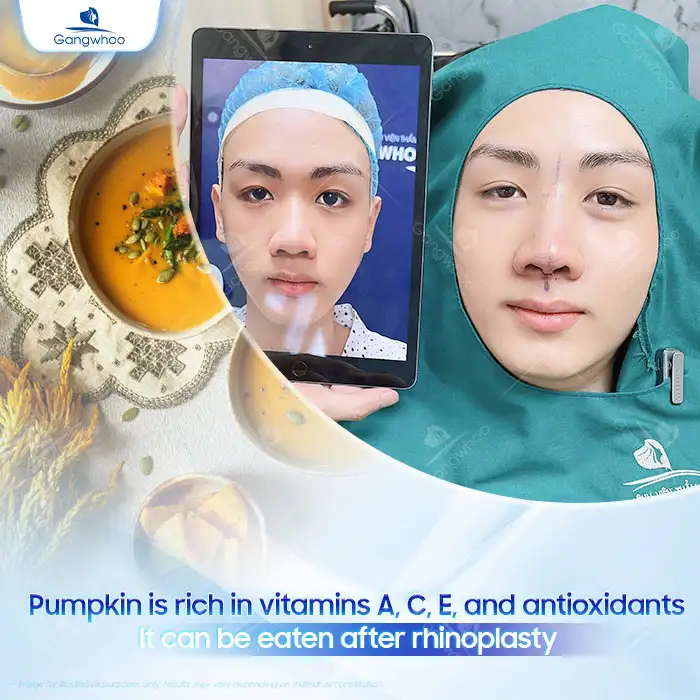 Can you eat pumpkin after rhinoplasty? Do you need to avoid it? 1 Can you eat pumpkin after rhinoplasty? Do you need to avoid it?