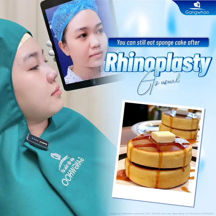 Can you eat sponge cake after nose augmentation? Are there any precautions?