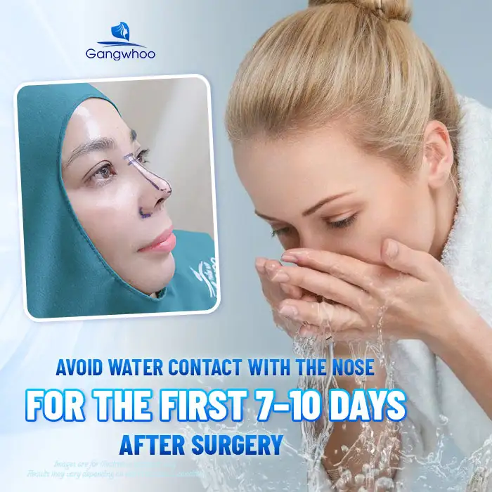 How Long Should You Avoid Water After Rhinoplasty? Proper Post-Rhinoplasty Care