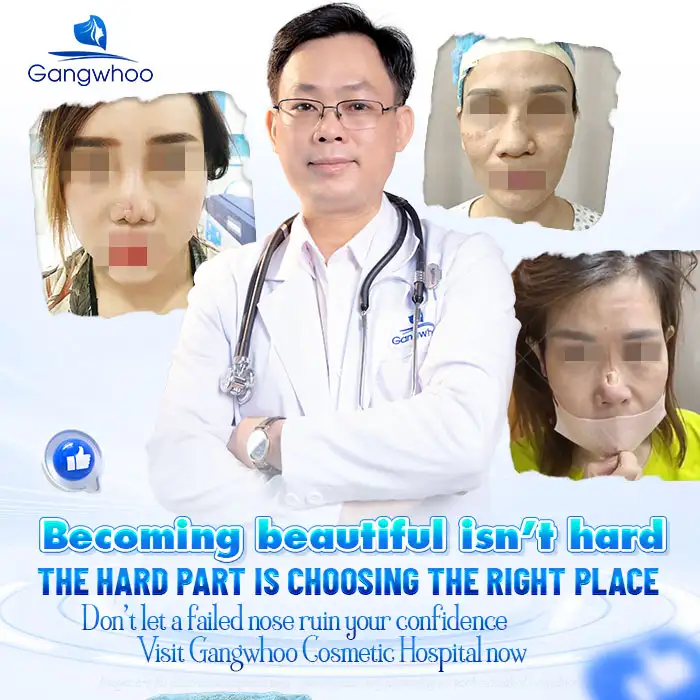 Is it harmful to revise or undergo multiple rhinoplasty procedures? When is revision rhinoplasty necessary?