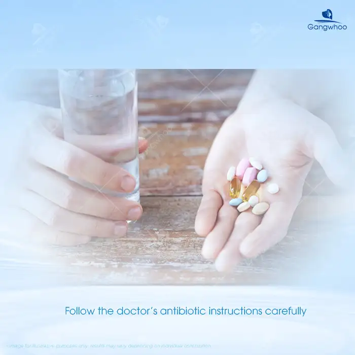 How long should antibiotics be taken after rhinoplasty? Is it necessary to take antibiotics after rhinoplasty?