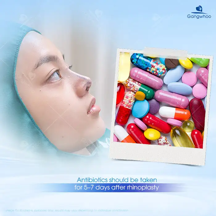 How long should antibiotics be taken after rhinoplasty? Is it necessary to take antibiotics after rhinoplasty?