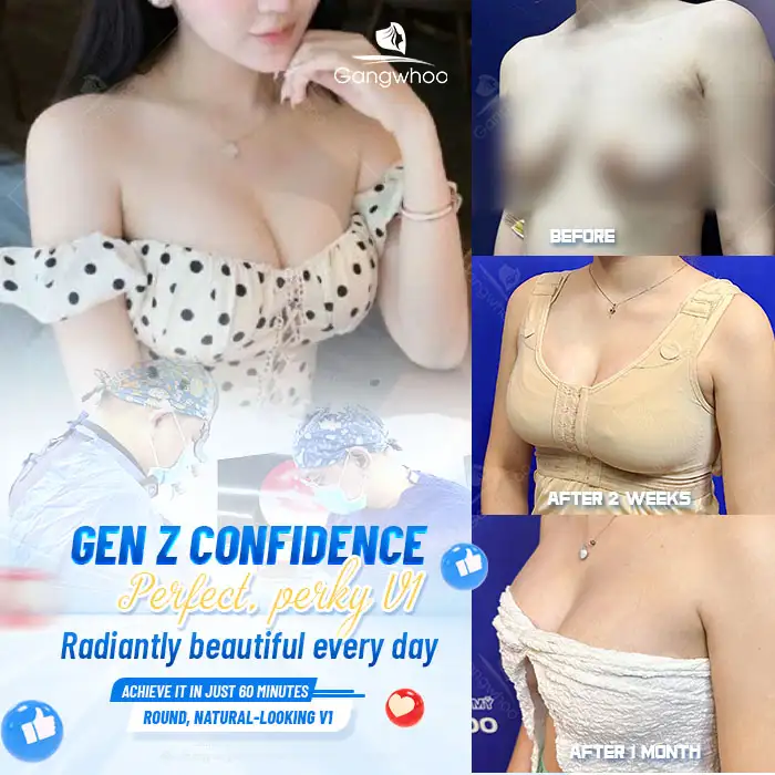 How Much Does Non-Surgical Breast Augmentation Cost? Latest 2025 Price List