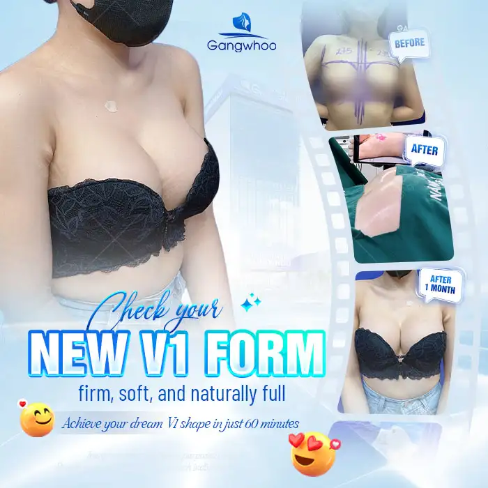 How Much Does Non-Surgical Breast Augmentation Cost? Latest 2025 Price List