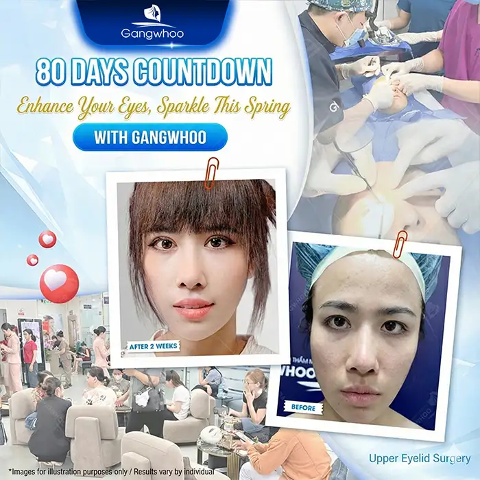 Should protruding eyes undergo double eyelid surgery? Will it affect the eyes?