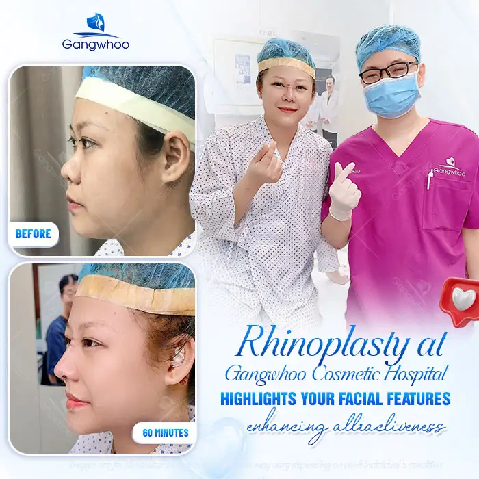 Will the Sutures Be Visible After Rhinoplasty? How to Care for Proper Wound Healing