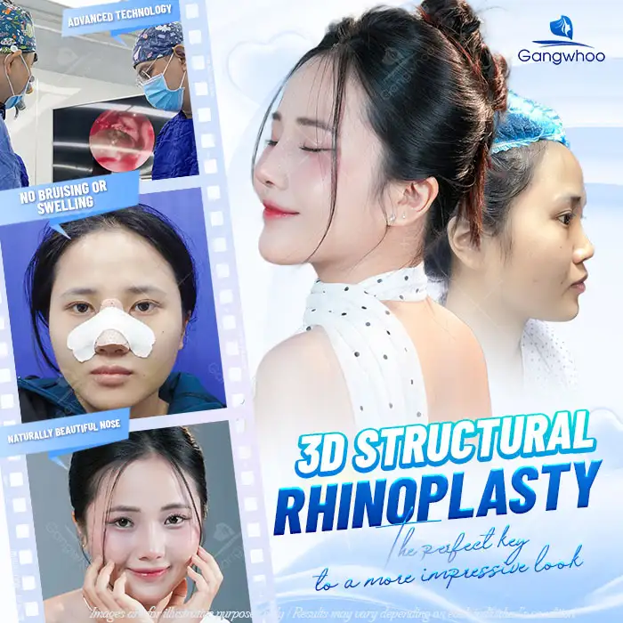 Will the Sutures Be Visible After Rhinoplasty? How to Care for Proper Wound Healing