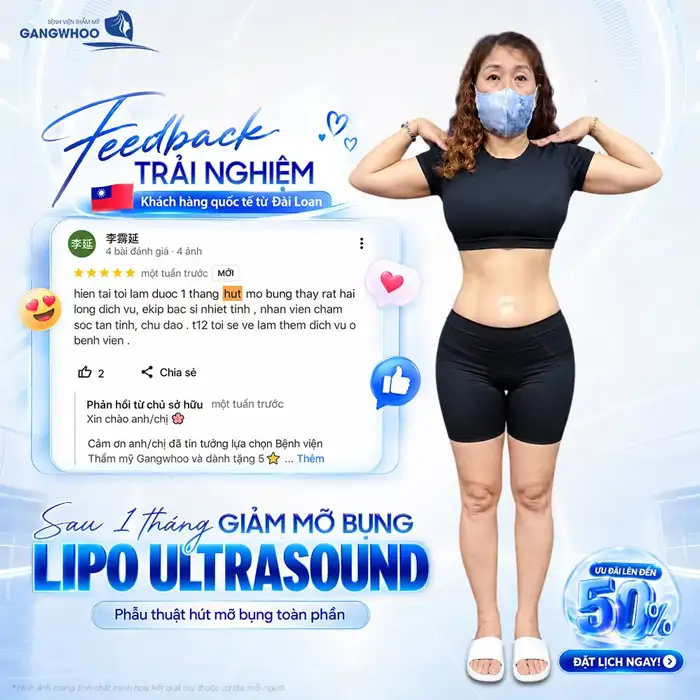 Hút Mỡ Bụng Công Nghệ Lipo Ultrasound – Giảm Mỡ An Toàn, Tạo Vóc Dáng Chuẩn Y Khoa